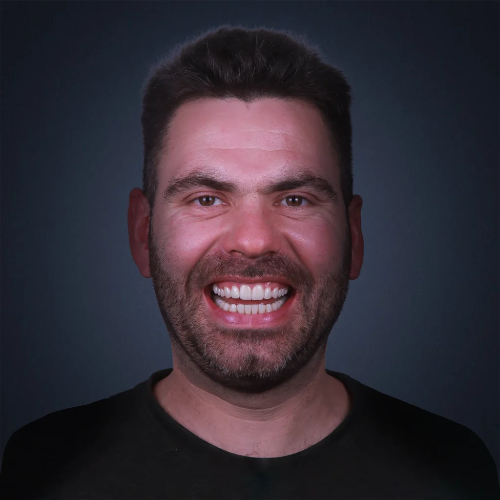 Man showing bright smile after cosmetic dentistry