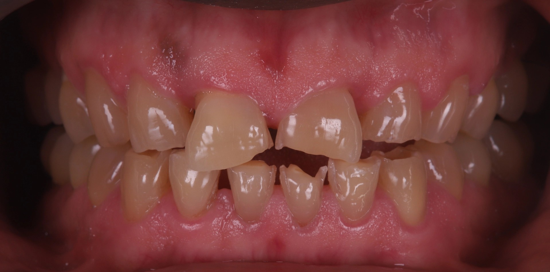 teeth-case-9-1