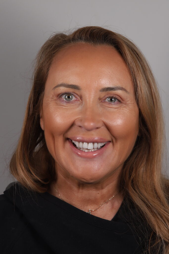 Bright smile showing veneers teeth transformation