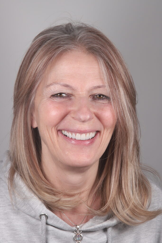 Cosmetic smile makeover with dental veneers