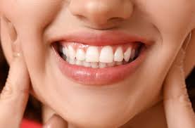 Close-up of a bright smile with healthy gums, showcasing the results of gum bleaching
