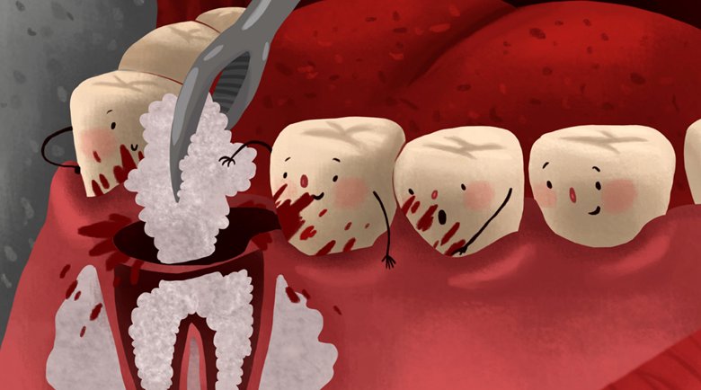 Bone Grafting- Dr Arman Barfeie Prosthodontist Official Website