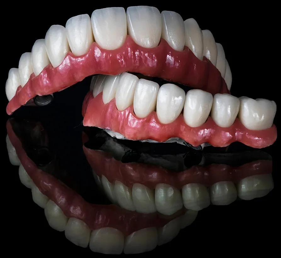 full-arch dental prosthetics for implant-supported teeth replacement