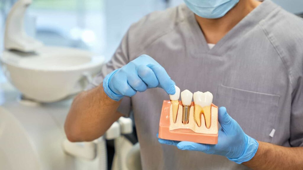 a dental implant model, with the components of an artificial tooth including crown, abutment, and titanium root