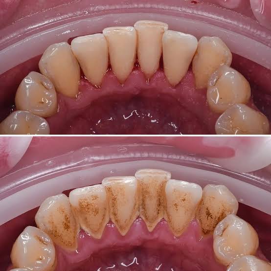 Periodontics- Dr Arman Barfeie Prosthodontist Official Website