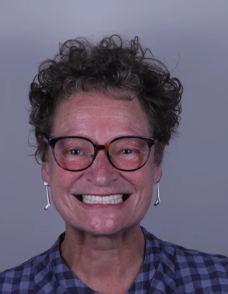 A woman smiling showing her dental implants