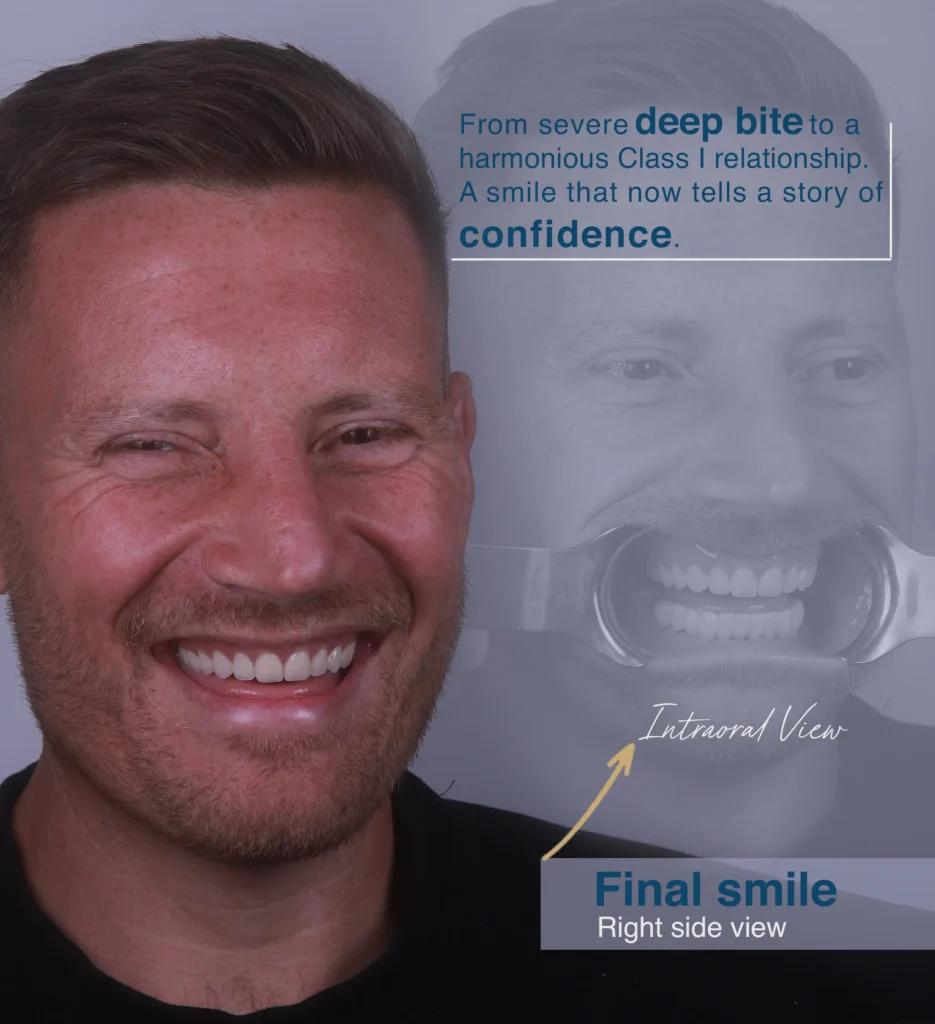 Dental Implants in Forest Hill, London- Dr Arman Barfeie Prosthodontist Official Website