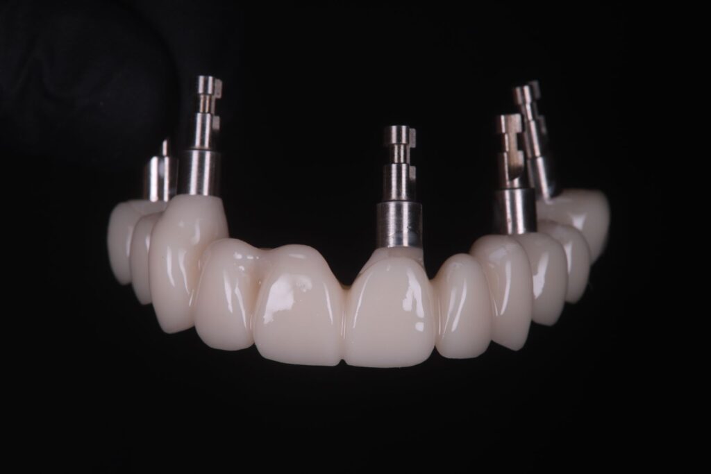 Cosmetic Dentistry- Dr Arman Barfeie Prosthodontist Official Website