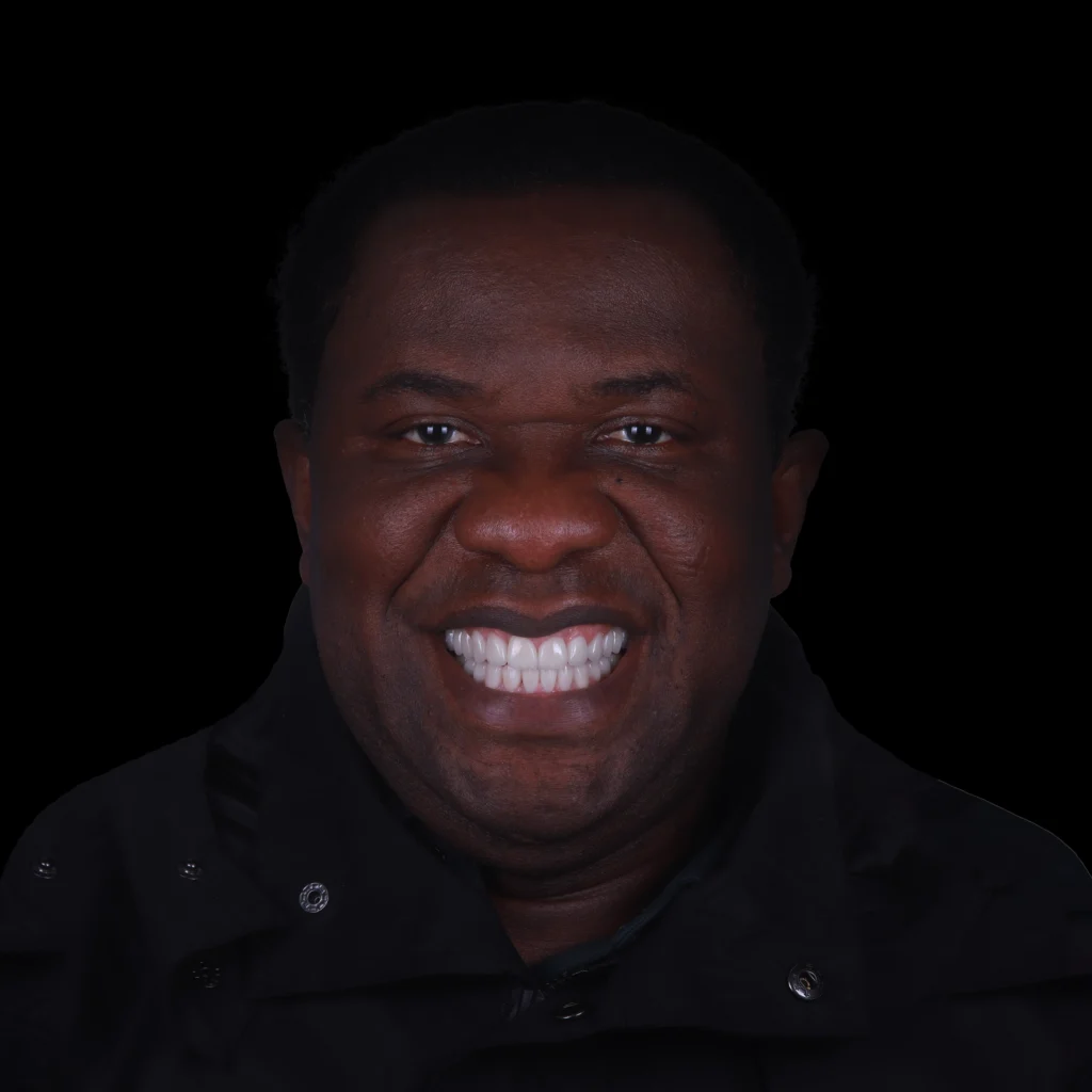 Veneers- Dr Arman Barfeie Prosthodontist Official Website