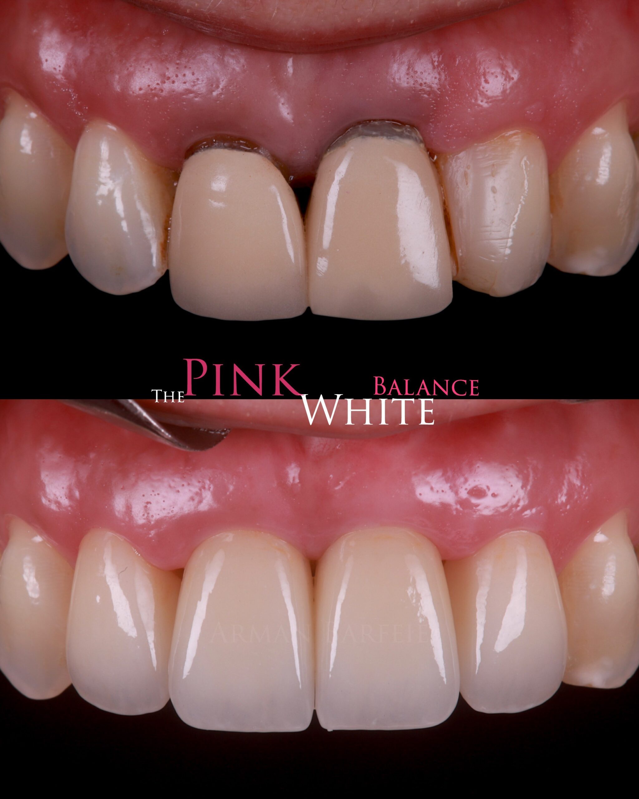 Case Libraries- Dr Arman Barfeie Prosthodontist Official Website