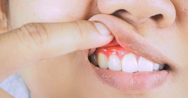 Dental Implants Aren’t for Everyone — Discover If You’re the Perfect Candidate (in 4 Steps)- Dr Arman Barfeie Prosthodontist Official Website