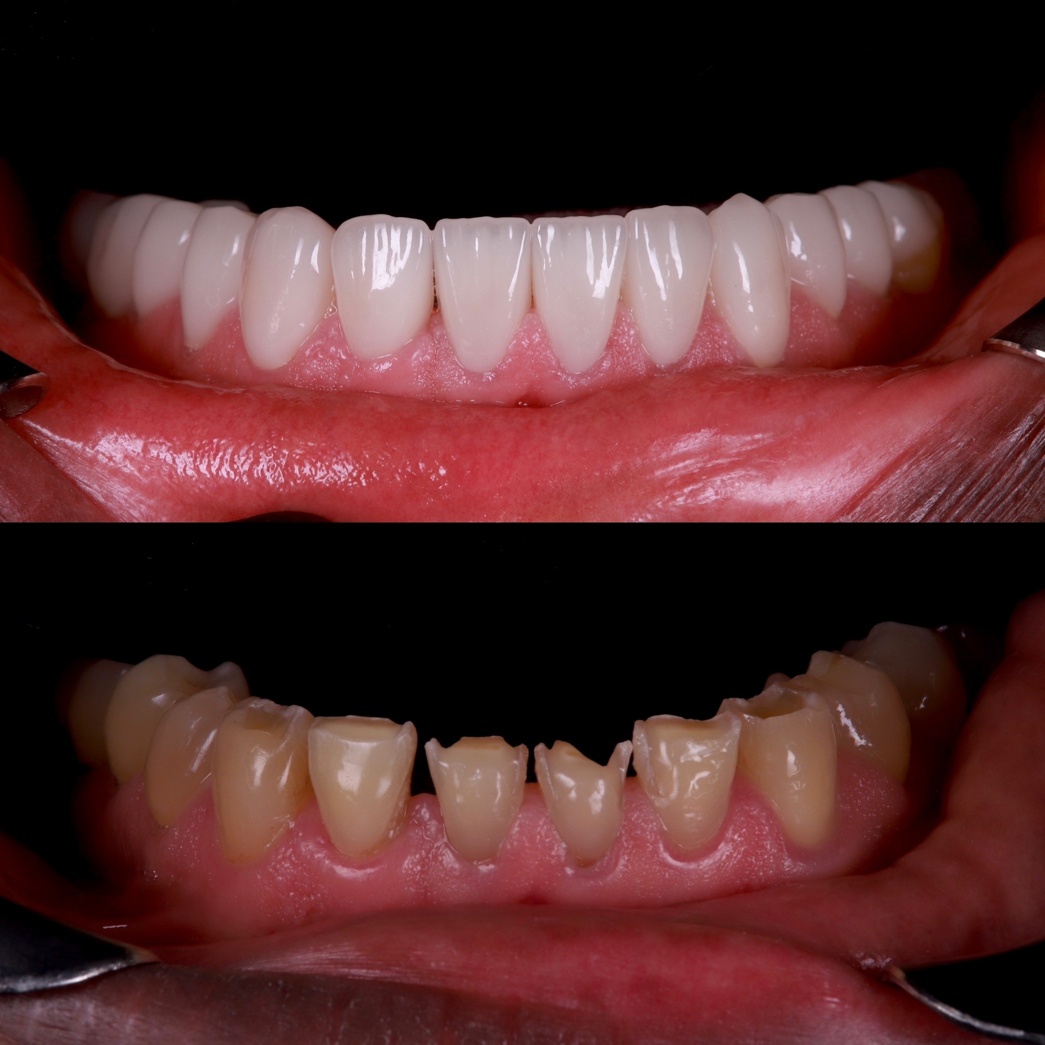 Academy- Dr Arman Barfeie Prosthodontist Official Website